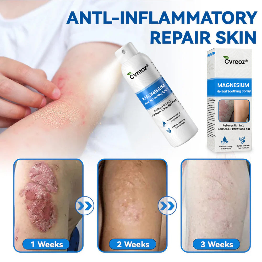 ✅  Official Store:KUBOZN® Magnesium Herbal Spray – Fast Relief for Psoriasis & Eczema | No-Rub, Steroid-Free (OFFER)