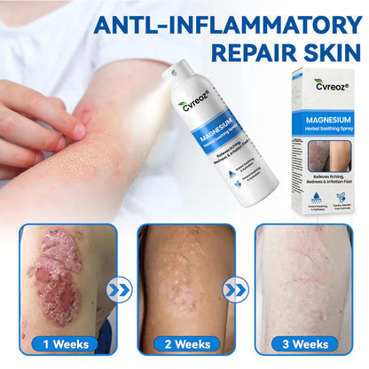 ✅  Official Store:KUBOZN® Magnesium Herbal Spray – Fast Relief for Psoriasis & Eczema | No-Rub, Steroid-Free (OFFER)
