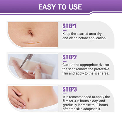 🪡 Cvreoz® Nano Microneedle Repair Tape — When Scar Creams Don’t Work 🅱︎