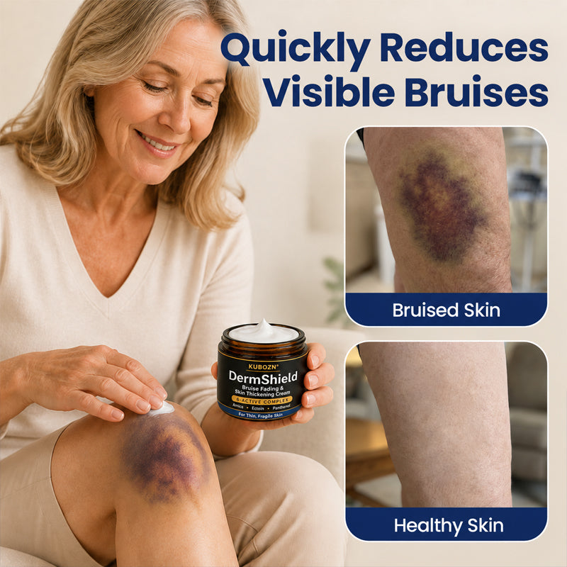 KUBOZN® DermShield - Advanced Bruise Fading & Skin Thickening Cream for Thin, Fragile Skin