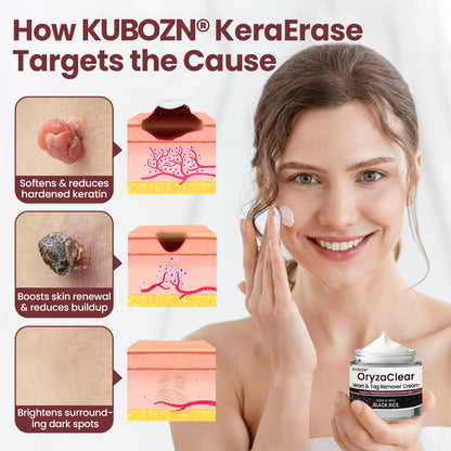 🌿 KUBOZN® OryzaClear – Black Rice Power Cream for Skin Tags & Bumps · Gentle Plant-Based Softening Formula 🅱︎