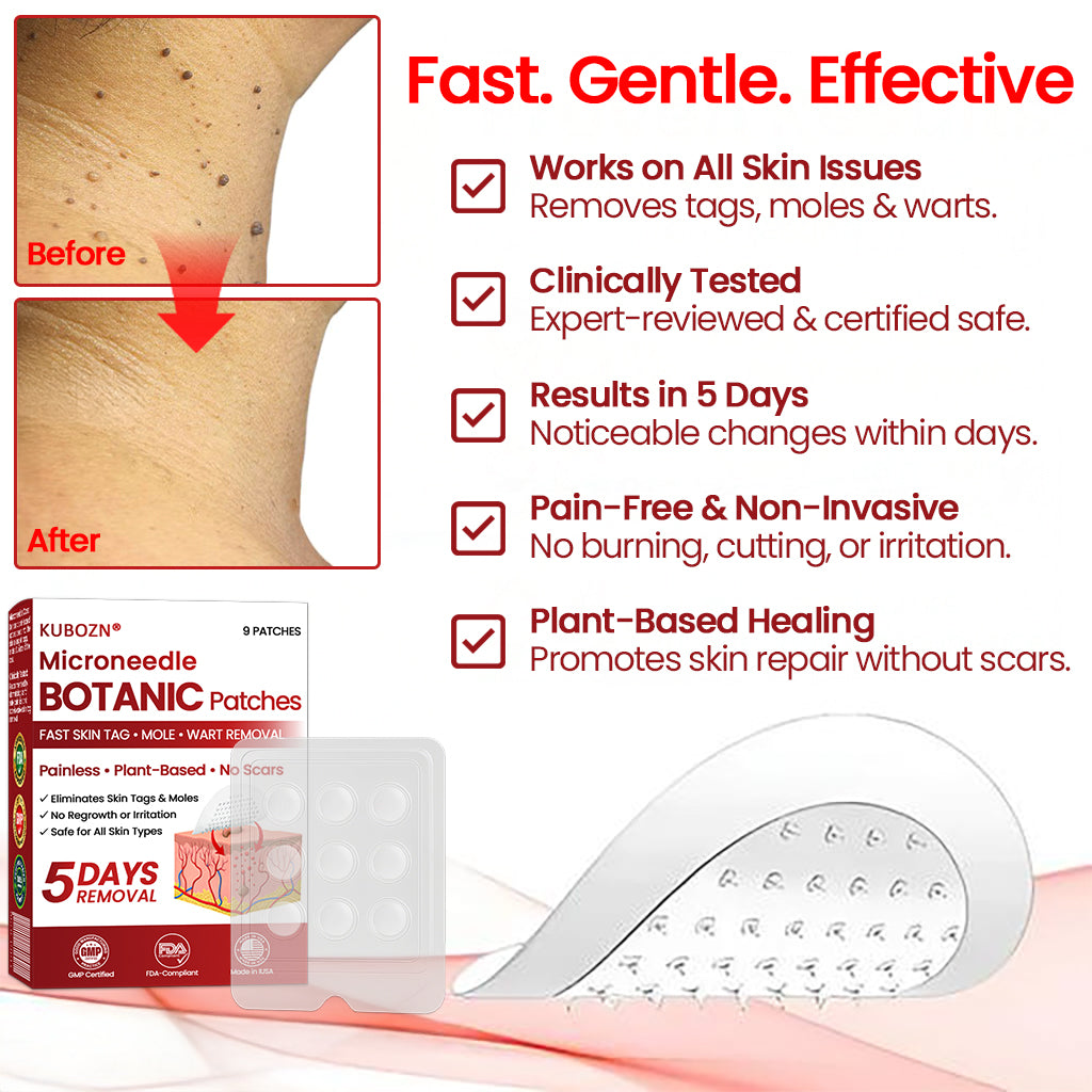 🔥 KUBOZN® Microneedle Skin Tag Removal Patches – Visible Results in 5 Days