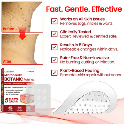 🔥 KUBOZN® Microneedle Skin Tag Removal Patches – Visible Results in 5 Days