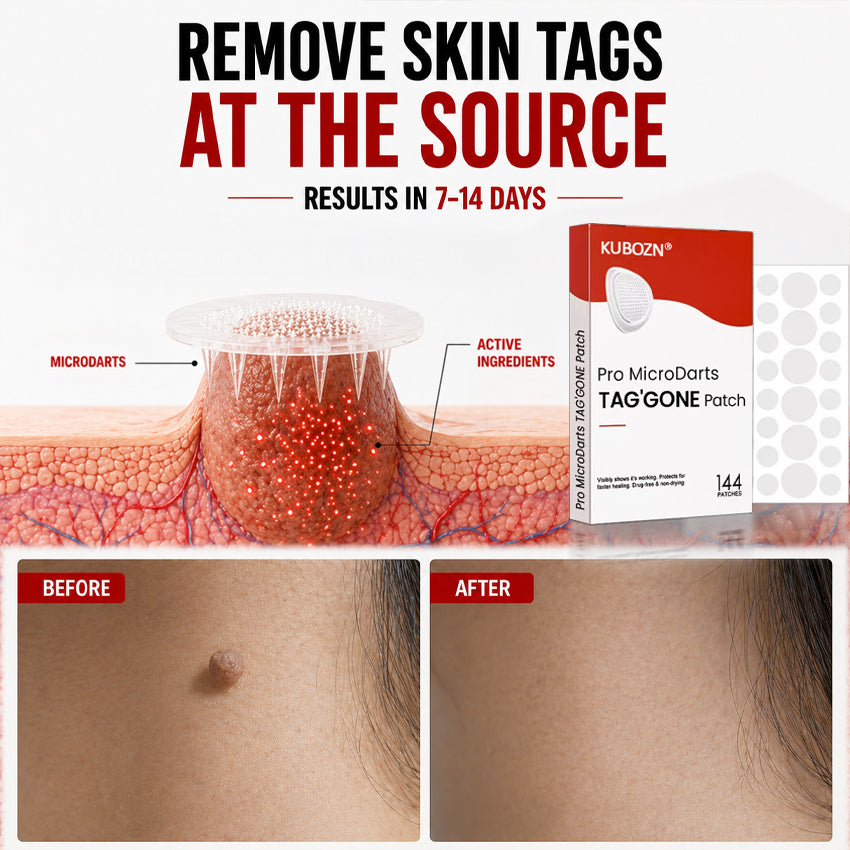 KUBOZN® Pro MicroDarts TAG'Gone Patch 🅱︎
