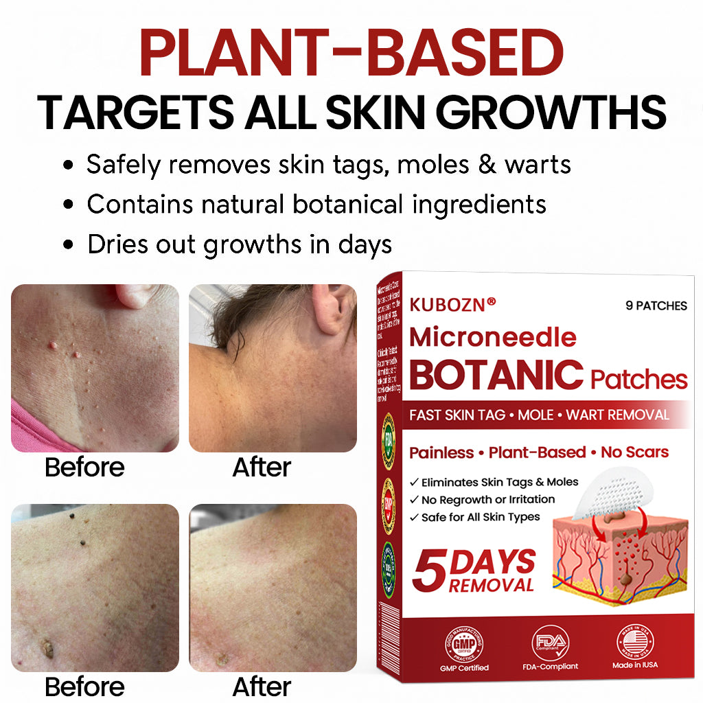 🔥 KUBOZN® Microneedle Skin Tag Removal Patches – Visible Results in 5 Days