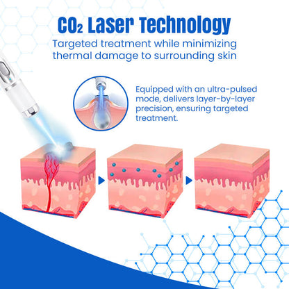 Bikenda® DermZap Mole & Wart Removal Laser Pen