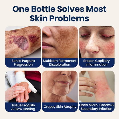 KUBOZN® DermShield - Advanced Bruise Fading & Skin Thickening Cream for Thin, Fragile Skin