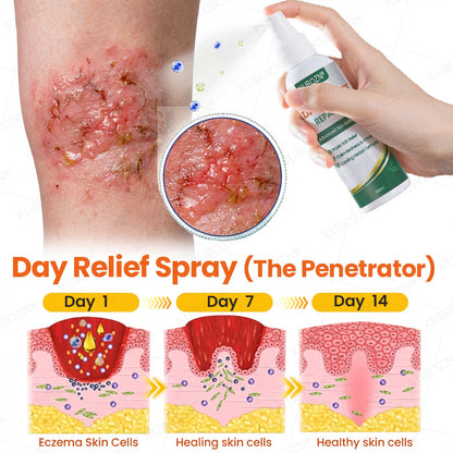 KUBOZN® Eczema Day & Night Repair System - 100% Steroid-Free Relief Duo for Intense Itch, Redness & Broken Skin (offer)