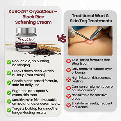 🌿 KUBOZN® OryzaClear – Black Rice Power Cream for Skin Tags & Bumps · Gentle Plant-Based Softening Formula 🅱︎