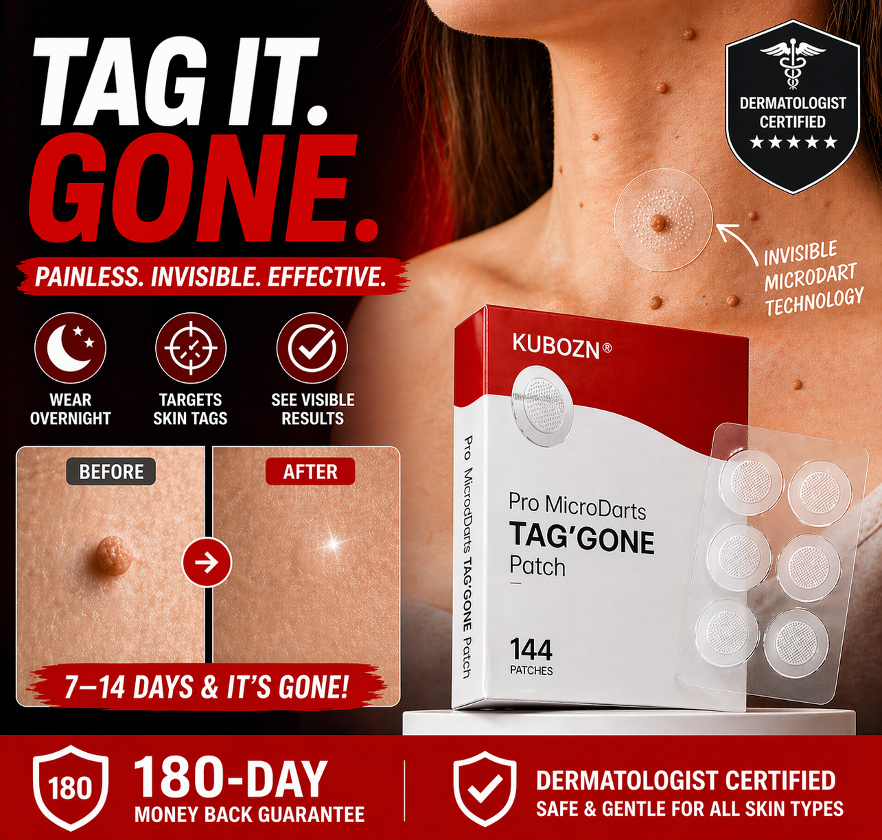 ✨ KUBOZN® Pro MicroDarts TAG'Gone Patch