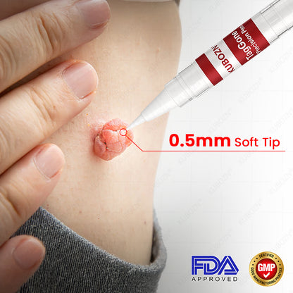 ✨KUBOZN® TagGone Precision Pen (2025 Upgrade) | Skin Tag, Mole & Wart Remover – Fast, Gentle & Scar-Free in 5 Days 🅱︎