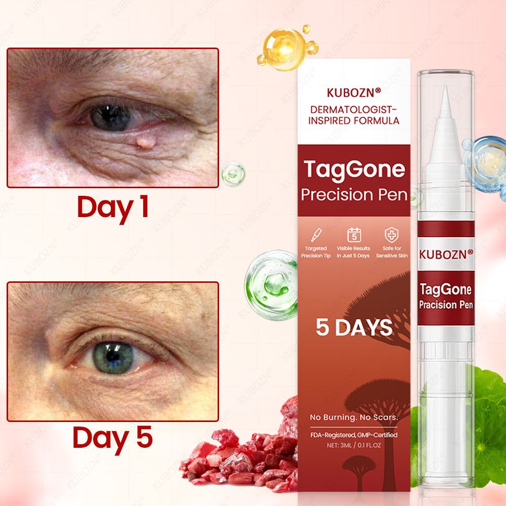 ✨KUBOZN® TagGone Precision Pen (2025 Upgrade) | Skin Tag, Mole & Wart Remover – Fast, Gentle & Scar-Free in 5 Days 🅱︎