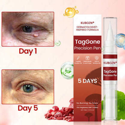 ✨KUBOZN® TagGone Precision Pen (2025 Upgrade) | Skin Tag, Mole & Wart Remover – Fast, Gentle & Scar-Free in 5 Days 🅱︎